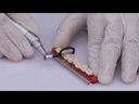 Contra angulo reductor de sistema dental IRP 4:1 con irrigacion interna y puntas de plastico (Tealth)