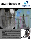 Sensor Intraoral - Modelo Nanopix PRO 1.4 - con Diagnostico - IA - en la Nube - Eighteeth