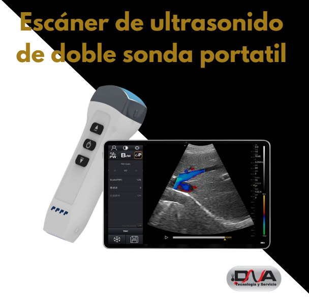 Escáner de ultrasonido de doble sonda portatil (Dawei)